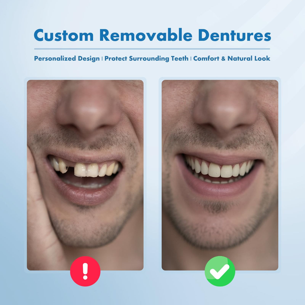 Custom Removable Dentures Set (1 Tooth) V477