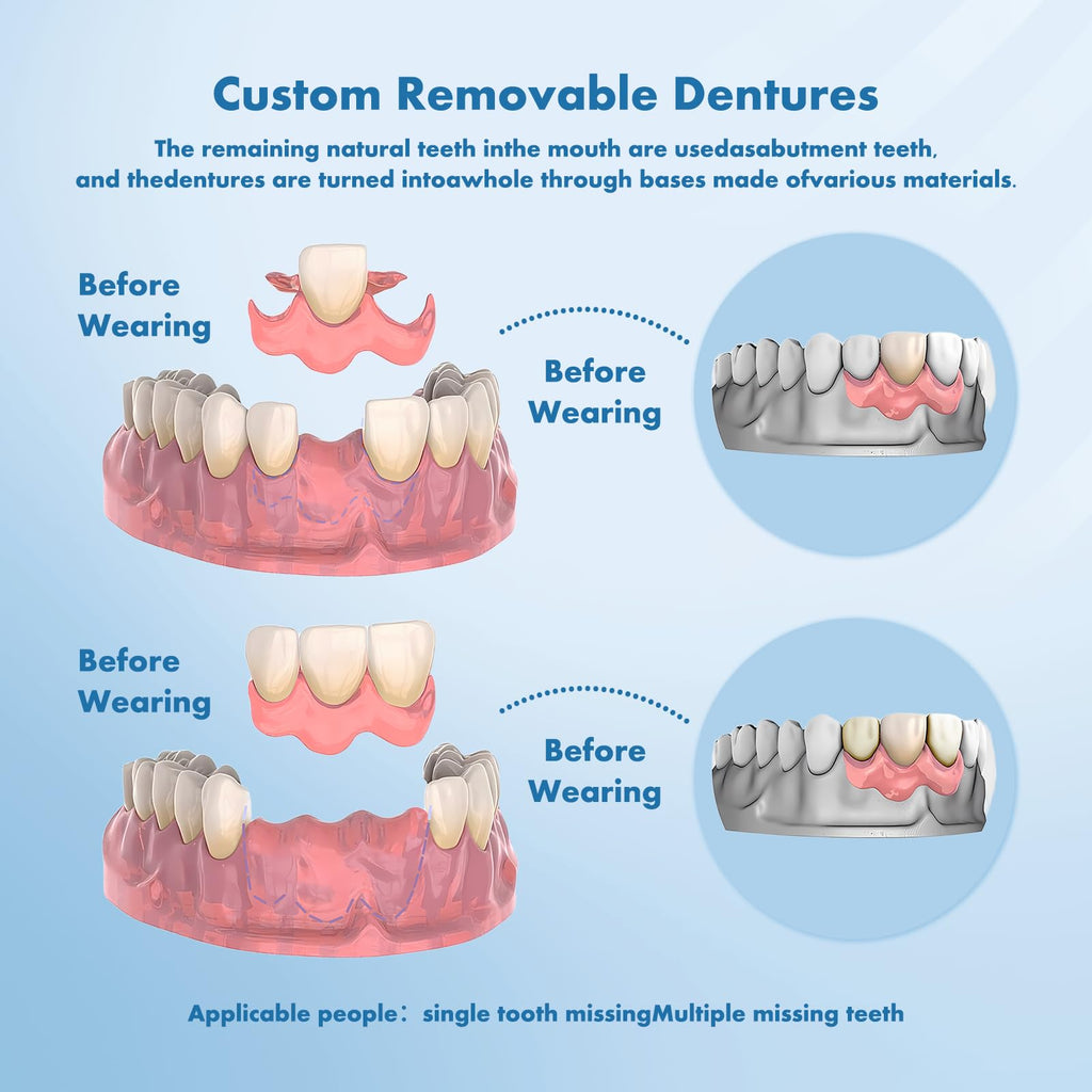 Custom Removable Dentures Set (1 Tooth) V477